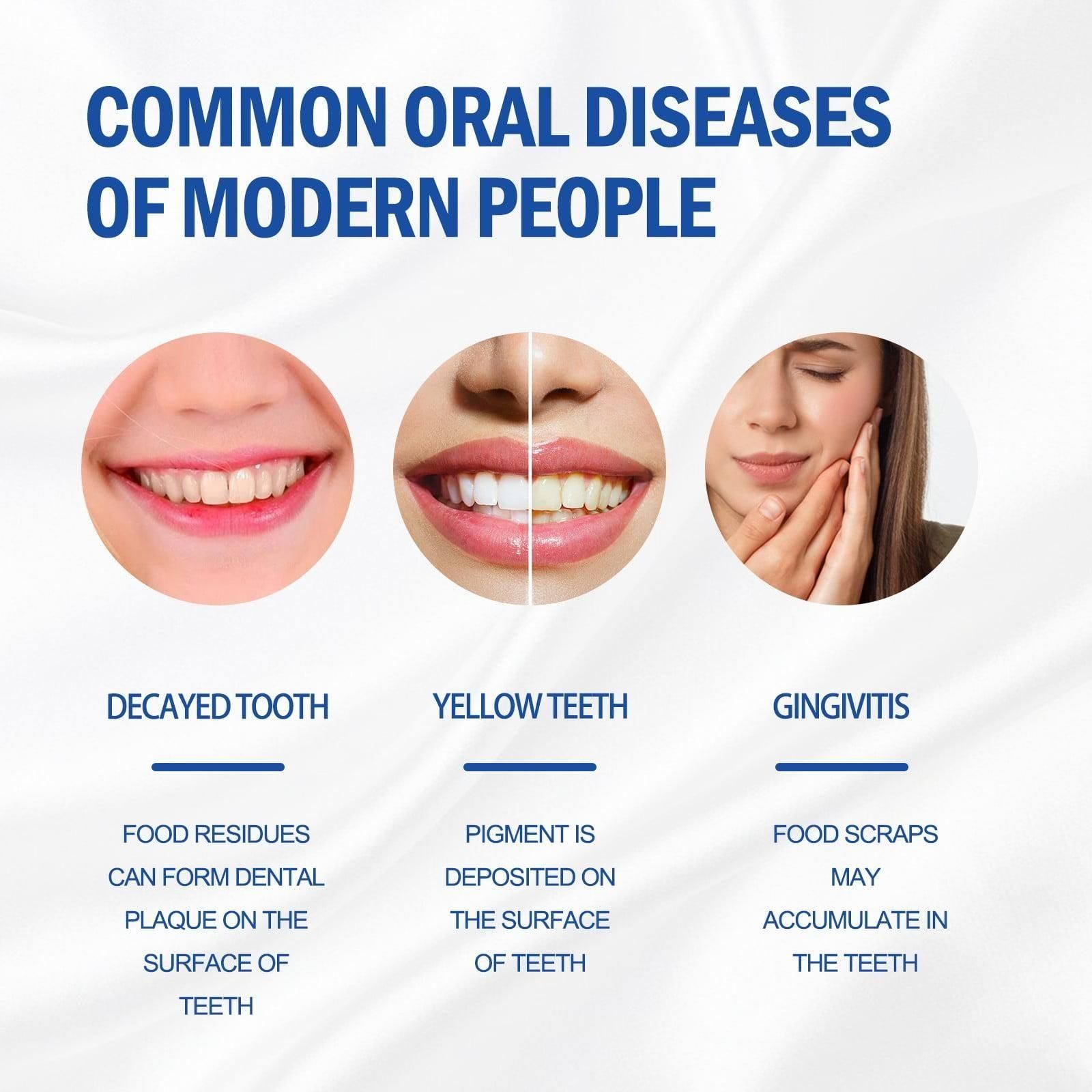 Ultra Whitening Sp 4 Probiotic Toothpaste