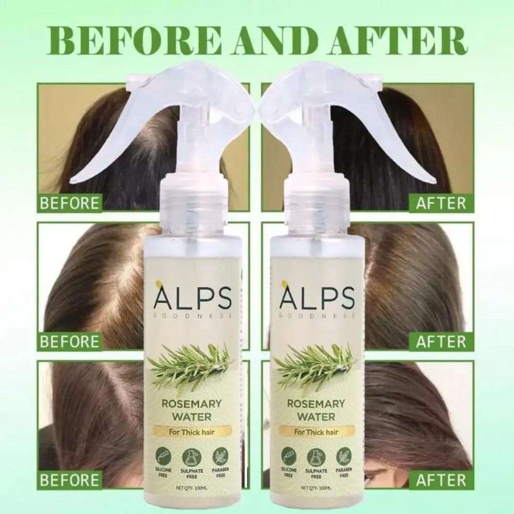 🔥 BUY 1 GET 2 FREE 🔥 ROSEMARRY WATER, HAIR SPRAY ⭐⭐⭐⭐⭐ RATING 4.9